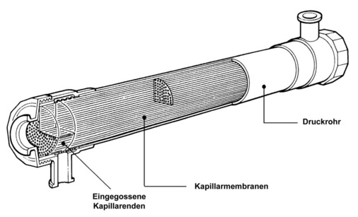 Membranaufbau mit Druckrohr — Filtrationsrichtung von außen nach innen