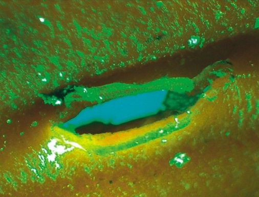 3 Zäher Durchbruch: Ursache für den Riss in der Schnittprobe war höchstwahrscheinlich Wasserdruck von innen.