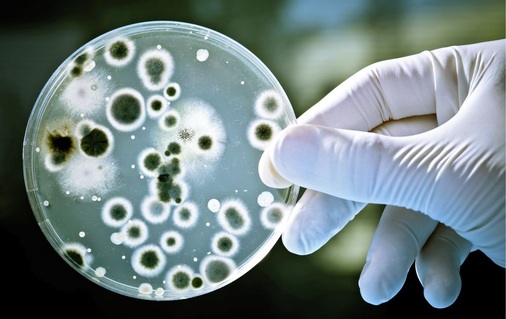 Der Nachweis: Auf dem Nährboden haben sich Bakterienkolonien (KBE) gebildet, die gezählt werden können.