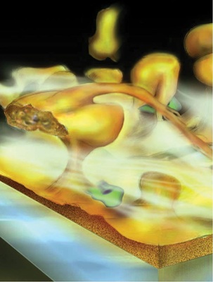 Biofilm — idealer Lebensraum für Legionellen.