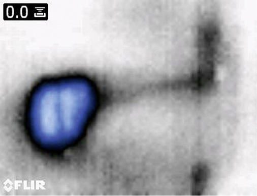 
Mit einer Wärmebildkamera aufgenommenes Bild einer senkrechten Wand, das den Durchgang eines schlecht isolierten Rohres und eine daraus resultierende Ablösung von Wandverkleidungen zeigt.
