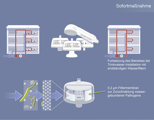 
Bei einer Kontamination der Trinkwasser-Installation mit Legionellen kann der Einsatz endständiger Wasserfilter eine überbrückende Notfallmaßnahme sein.
