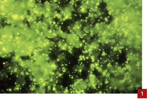 
Jede Kontamination mit Legionellen kann eine Gesundheitsgefährdung darstellen. Ist der technische Maßnahmenwert für Legionellen auch nur geringfügig überschritten, ist eine Gefährdungsanalyse obligatorisch.
