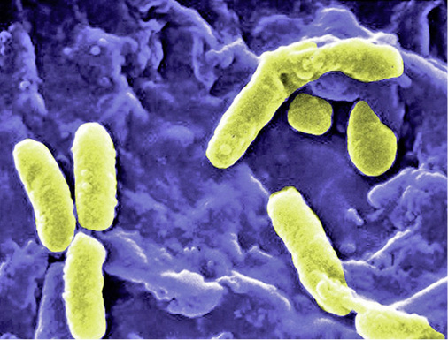 
Da Bakterien in einem nicht kultivierbaren Zustand (VBNC) im Biofilm unentdeckt bleiben können, ist bei konkreten Prädikatoren die mikroskopische Auszählung der Gesamtzellzahl zu empfehlen.




