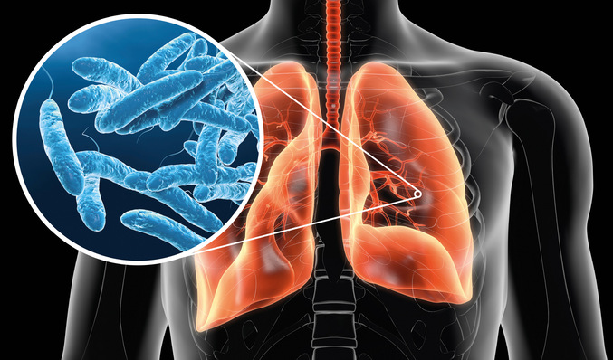 Das Einatmen von legionellenhaltigen, lungengängigen Aerosolen kann zu einer Gefährdung der menschlichen Gesundheit führen. Daher sind regelmäßige Trinkwasseruntersuchungen für viele Gebäude gesetzlich vorgeschrieben.﻿